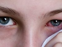 Conjuntivite: o que é, sintomas e tratamentos médicos ou caseiros