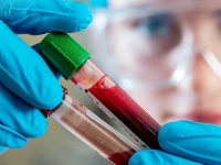 O que é leucemia, quais seus sintomas e tratamentos