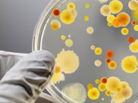 Fungos: Por que 75% das mulheres podem sofrer com infecções fúngicas?