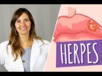 Alimentos para tratar e prevenir herpes