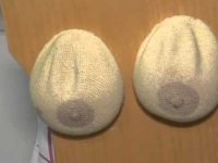 Aprenda a fazer o autoexame para detectar o câncer de mama