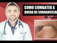 Causas e dicas para combater a queda de sobrancelha
