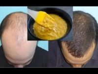 Chega de queda! Como preparar um super remédio para queda de cabelo