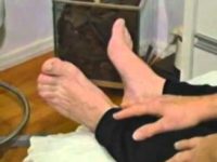 Como eliminar calos e calosidades