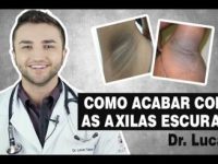 Manchas na pele: 5 dicas para clarear a virilha e axila