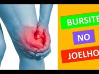 O que é e como tratar uma bursite no joelho?