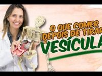 O que posso comer após a retirada da vesícula? Veja dicas