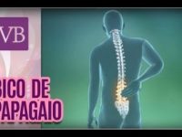 Osteofitose: qual a causa do bico de papagaio?