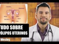 Polipo uterino: o que é, causas e sintomas