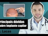 Principais dúvidas sobre implante capilar que você sempre quis saber