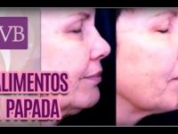 Super dicas de dieta para quem sofre de refluxo gastroesofágico