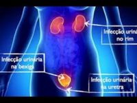 Super remédio caseiro para limpar rins e combater infecção urinária