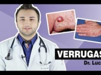 Verrugas: o que são e quais os tratamentos?